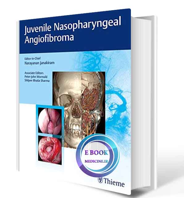 دانلود کتاب Juvenile Nasopharyngeal Angiofibroma 2020 (ORIGINAL PDF)